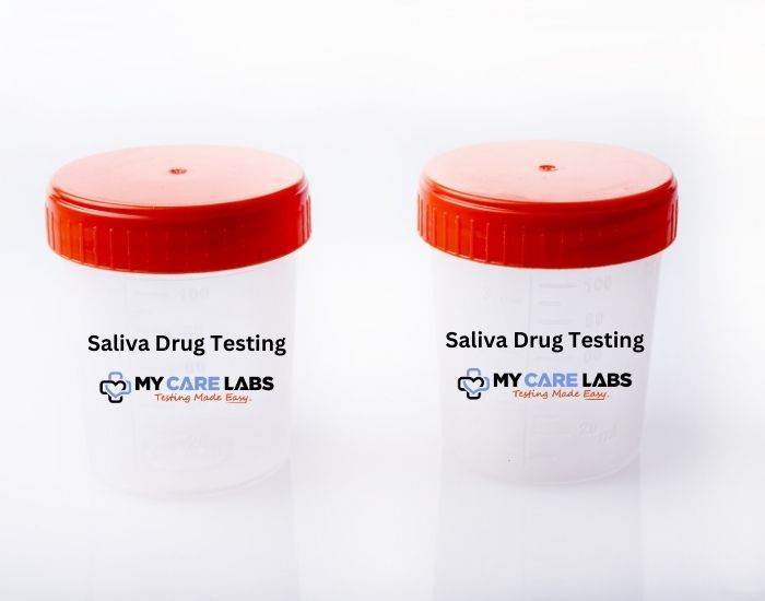 What is the Difference between Urine and Saliva Drug Testing