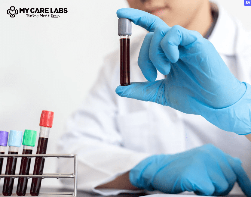 Low MCV and MCH in blood | Causes, Tests and Treatments