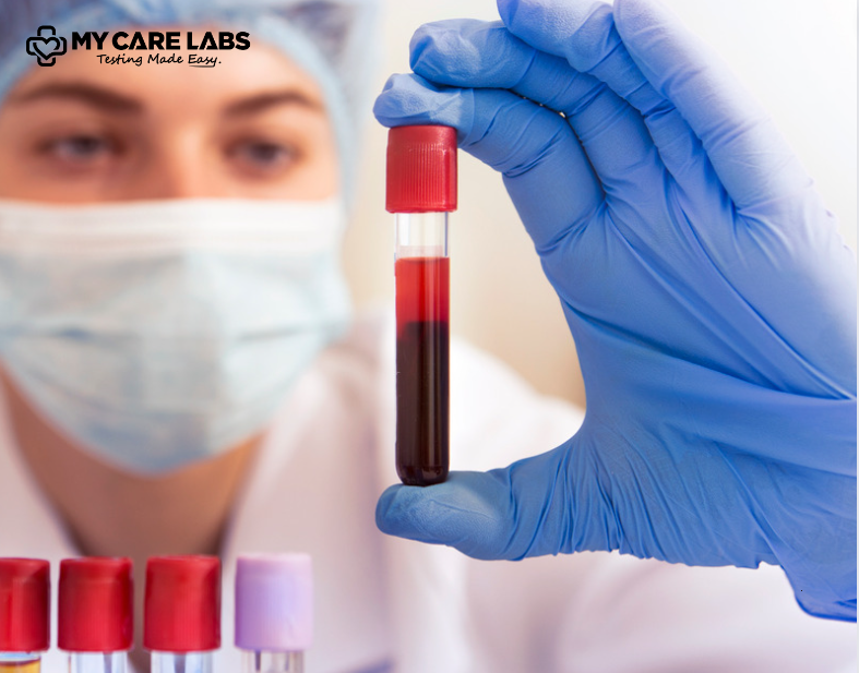 Blood test types | Blood Test Kits | Home Testing for Diabetes