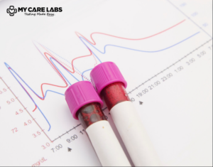 CRP Blood Test C-Reactive Protein Levels for Blood Analysis