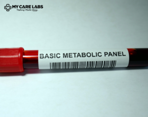 Basic Metabolic Panel test Complete metabolic panel test & tube color