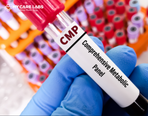 Comprehensive Metabolic Panel Blood Test & Interpreting Results