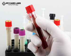 Liver Function Panel Blood Test for Comprehensive Assessment